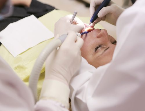 10 Safest Ways to Avoid Dental Emergencies